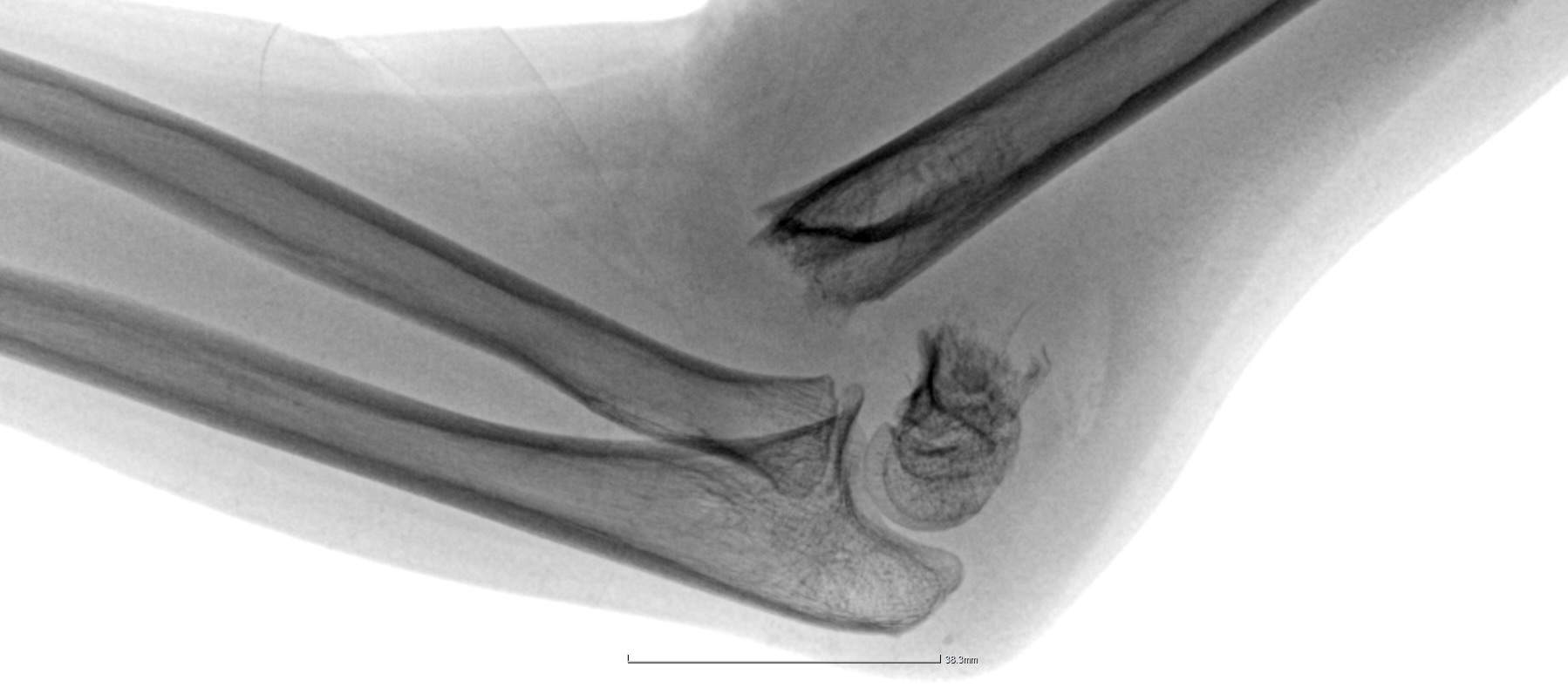 2025 Gyermekreanimációs ajánlás